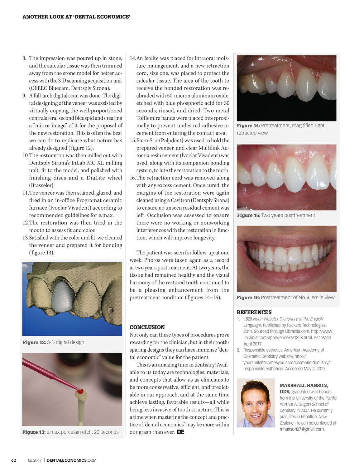 Dental Economics June 2017 Page 61 - 