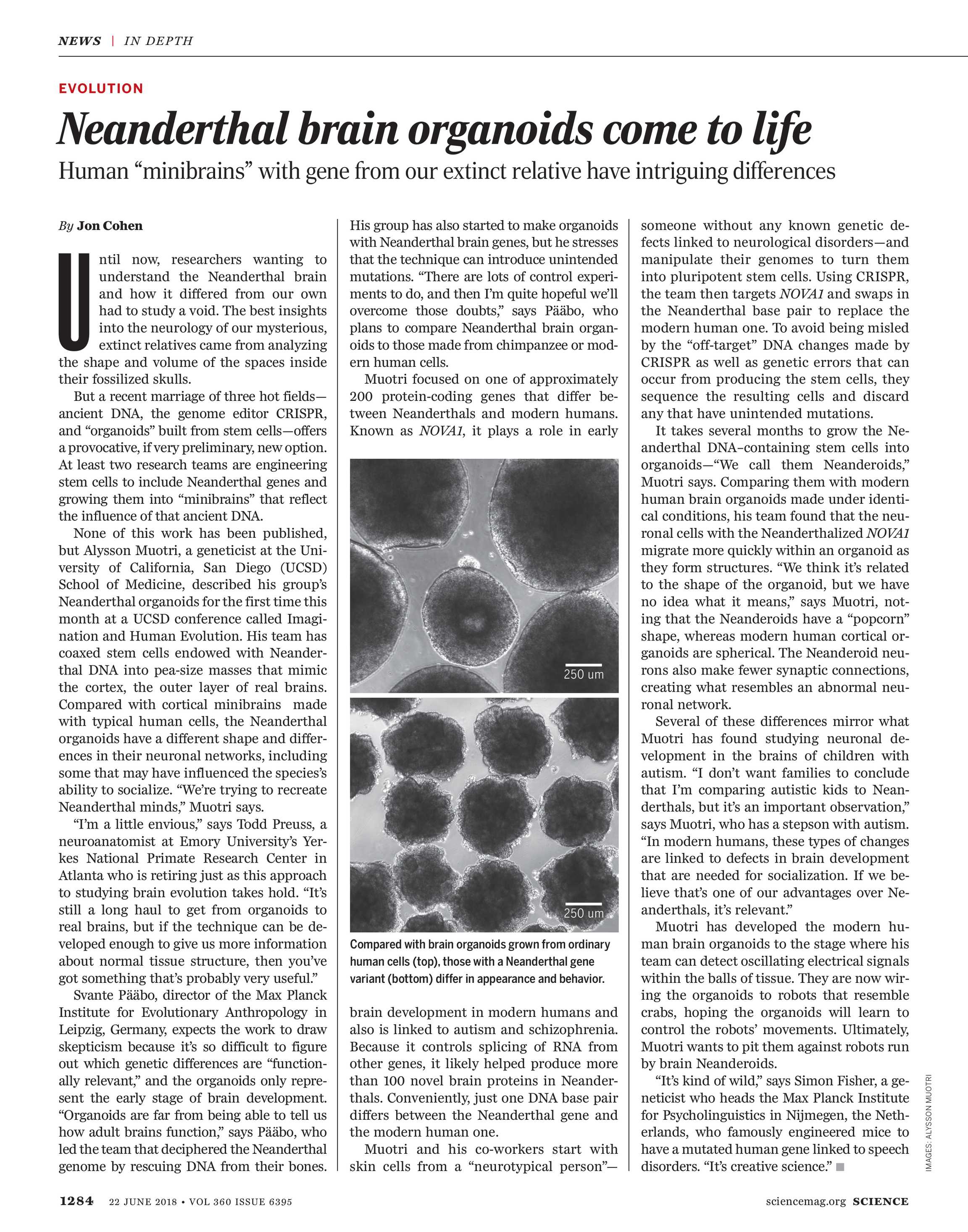Brain Cell Development Differs In Those >> Science Magazine June 22 2018 Page 1284 Brain Cell Development Differs In Those >> Science Magazine June 22 2018 Page 1284